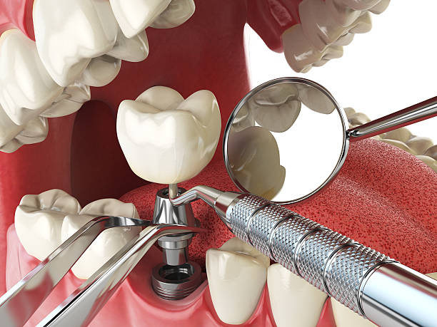 Best Emergency Gum Treatment in Taft, CA